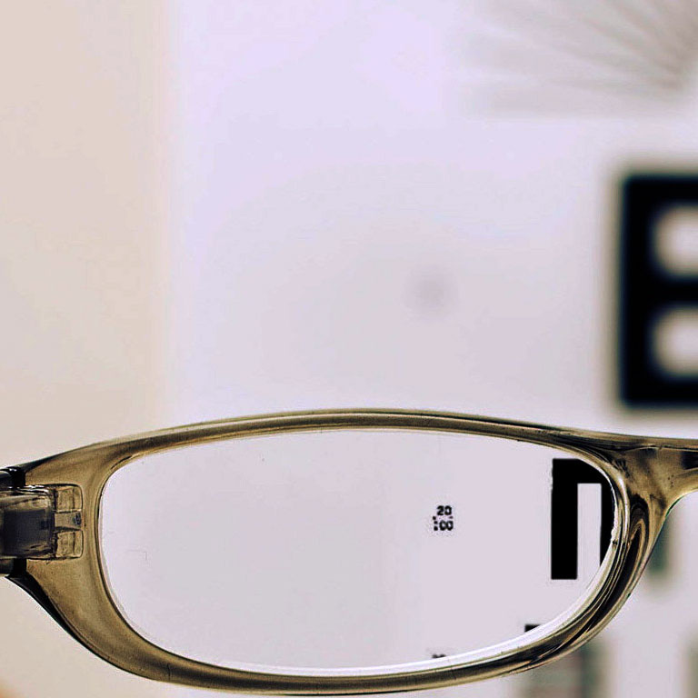 Myopia